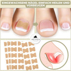 Nail Repair Patches – Instant Fix for Cracked & Split Nails Grab3